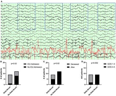 Extreme Delta Brush in Anti-NMDAR Encephalitis Correlates With Poor Functional Outcome and Death